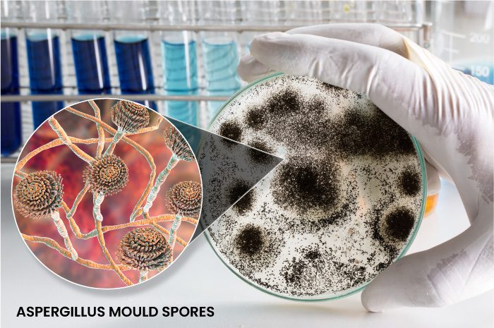 aspergillus